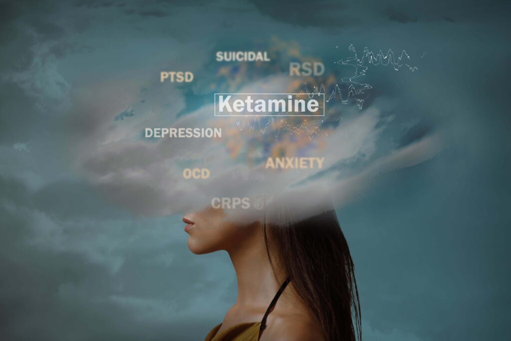 ketamine treatment